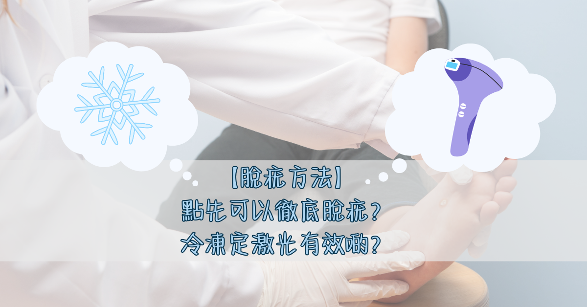 【脫疣方法】點先可以徹底脫疣？冷凍定激光有效啲？