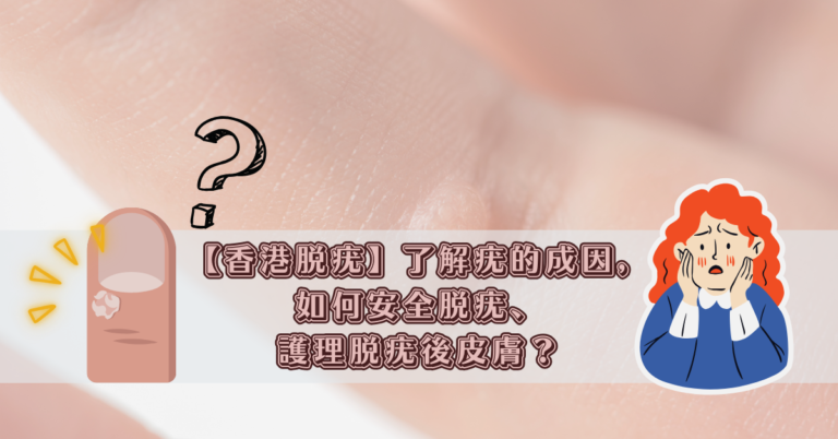 【香港脫疣】了解疣的成因，如何安全脫疣、護理脫疣後皮膚？