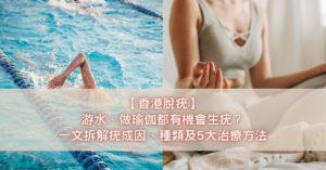 【香港脫疣】游水、做瑜伽都有機會生疣？一文拆解疣成因、種類及5大治療方法