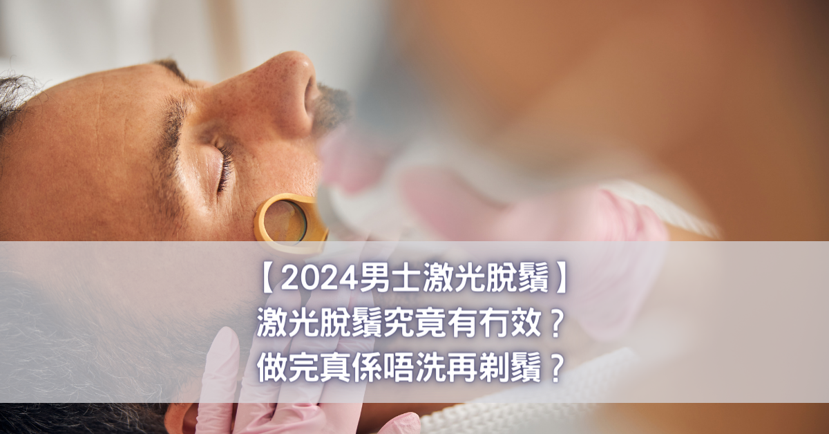 【2024男士激光脫鬚】激光脫鬚究竟有冇效？做完真係唔洗再剃鬚？