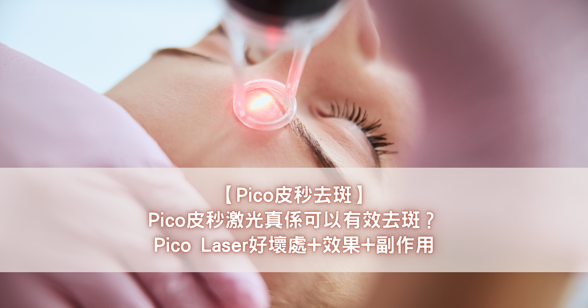 【Pico皮秒去斑】Pico皮秒激光真係可以有效去斑？Pico Laser好壞處+效果+副作用