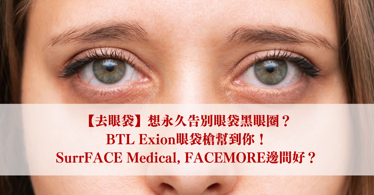 【去眼袋】想永久告別眼袋黑眼圈？BTL Exion眼袋槍幫到你！SurrFACE Medical, FACEMORE邊間好？