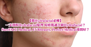 Hydrafacial