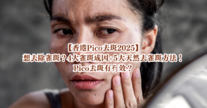 去斑