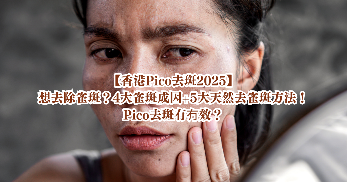 去斑